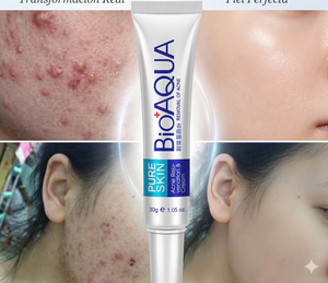 ✨ Recupera la Confianza en tu Piel: Bioaqua Pure Skin Acne Rejuvenation ✨