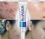 ✨ Recupera la Confianza en tu Piel: Bioaqua Pure Skin Acne Rejuvenation ✨